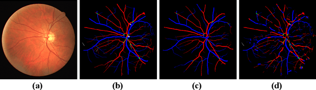 Figure 3 for TR-GAN: Topology Ranking GAN with Triplet Loss for Retinal Artery/Vein Classification