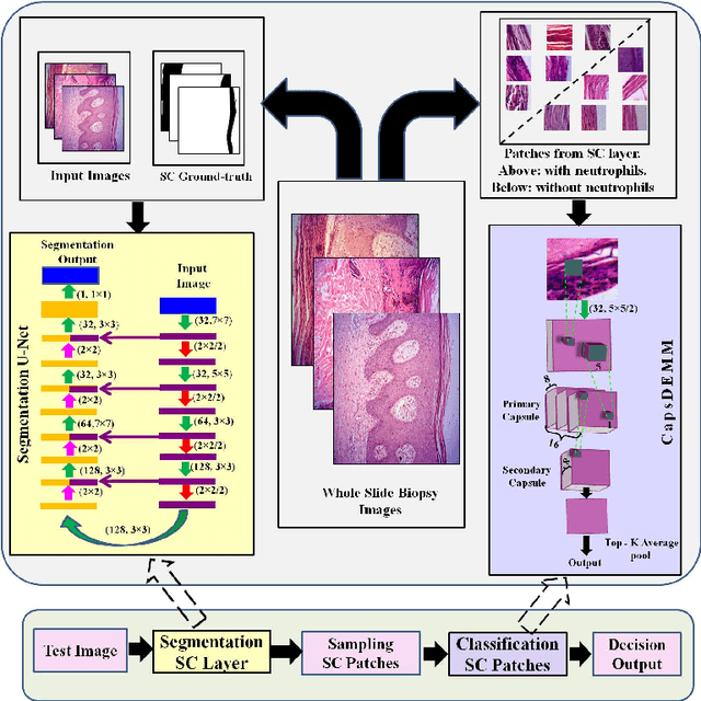 Figure 3 for CapsDeMM: Capsule network for Detection of Munro's Microabscess in skin biopsy images