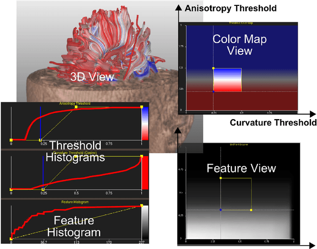 Figure 1 for Fuzzy Fibers: Uncertainty in dMRI Tractography