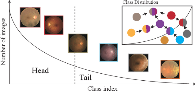 Figure 1 for Relational Subsets Knowledge Distillation for Long-tailed Retinal Diseases Recognition