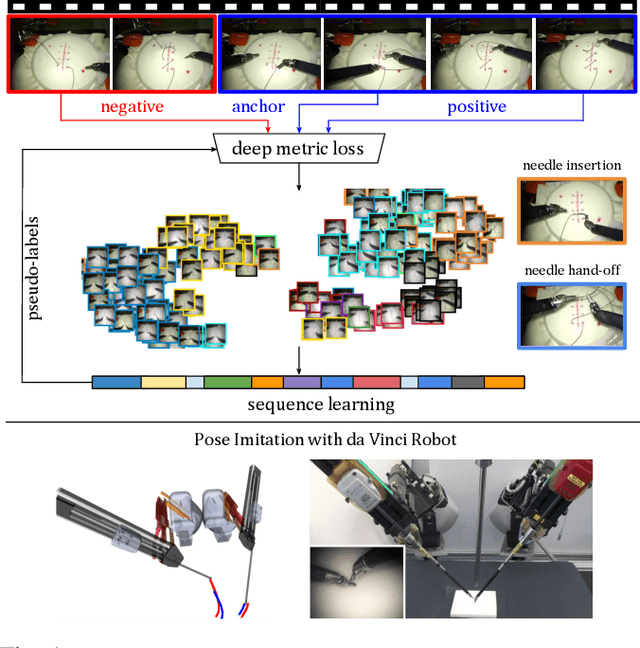 Figure 1 for Motion2Vec: Semi-Supervised Representation Learning from Surgical Videos