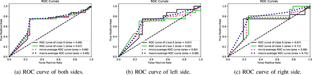 Figure 4 for Side-aware Meta-Learning for Cross-Dataset Listener Diagnosis with Subjective Tinnitus