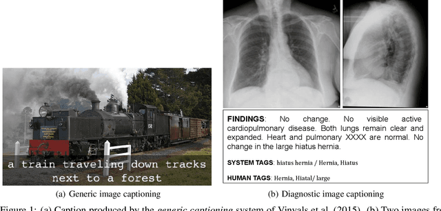 Figure 1 for Diagnostic Captioning: A Survey