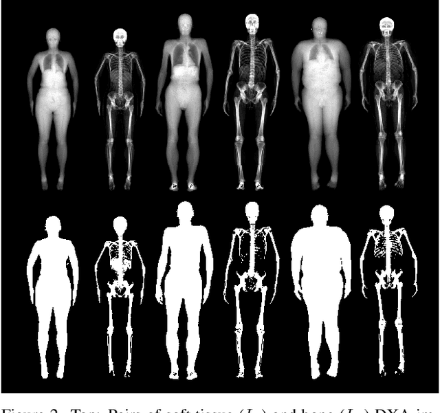 Figure 2 for OSSO: Obtaining Skeletal Shape from Outside