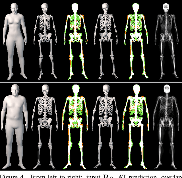 Figure 4 for OSSO: Obtaining Skeletal Shape from Outside