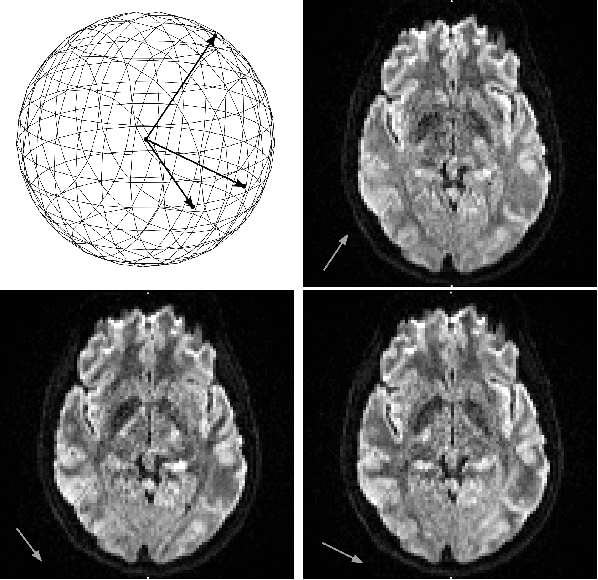 Figure 1 for Combining Image Space and q-Space PDEs for Lossless Compression of Diffusion MR Images