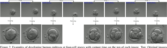 Figure 3 for EmbryosFormer: Deformable Transformer and Collaborative Encoding-Decoding for Embryos Stage Development Classification