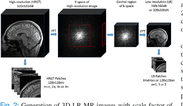 Figure 2 for 3D High-Quality Magnetic Resonance Image Restoration in Clinics Using Deep Learning
