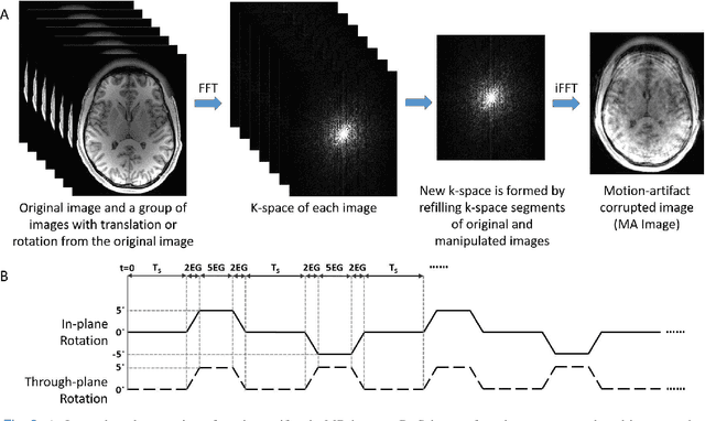 Figure 3 for 3D High-Quality Magnetic Resonance Image Restoration in Clinics Using Deep Learning