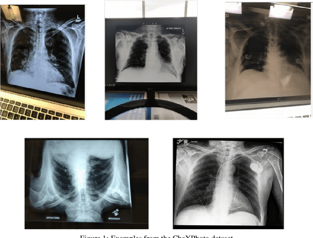 Figure 2 for Interpretation of smartphone-captured radiographs utilizing a deep learning-based approach