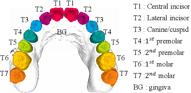 Figure 2 for Two-Stream Graph Convolutional Network for Intra-oral Scanner Image Segmentation