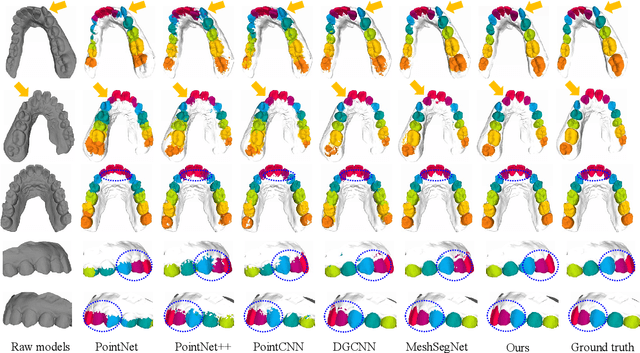 Figure 3 for Two-Stream Graph Convolutional Network for Intra-oral Scanner Image Segmentation