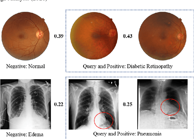 Figure 1 for Deep Triplet Hashing Network for Case-based Medical Image Retrieval