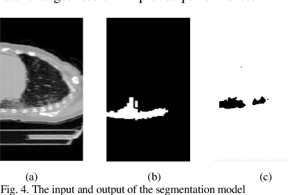 Figure 4 for A Novel Automated Classification and Segmentation for COVID-19 using 3D CT Scans