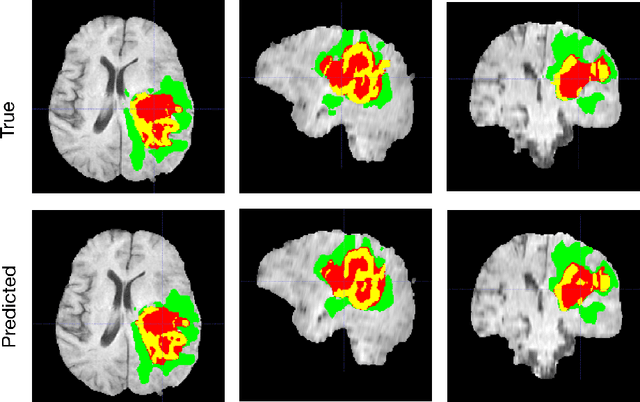Figure 2 for Redundancy Reduction in Semantic Segmentation of 3D Brain Tumor MRIs