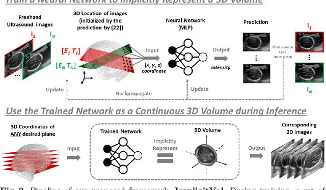 Figure 3 for ImplicitVol: Sensorless 3D Ultrasound Reconstruction with Deep Implicit Representation