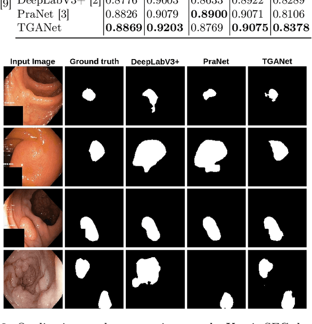 Figure 3 for TGANet: Text-guided attention for improved polyp segmentation