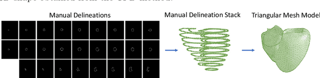 Figure 1 for 3D Cardiac Shape Prediction with Deep Neural Networks: Simultaneous Use of Images and Patient Metadata