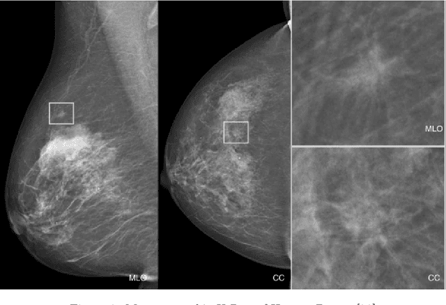 Figure 2 for Artificial Intelligence For Breast Cancer Detection: Trends & Directions