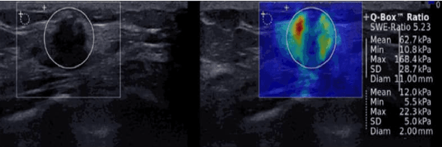 Figure 4 for Artificial Intelligence For Breast Cancer Detection: Trends & Directions