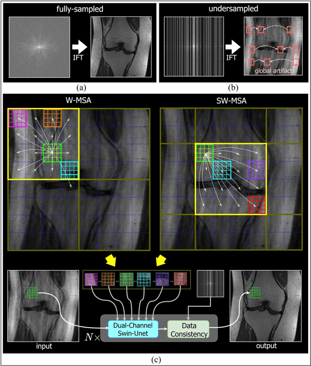 Figure 1 for Multi-head Cascaded Swin Transformers with Attention to k-space Sampling Pattern for Accelerated MRI Reconstruction