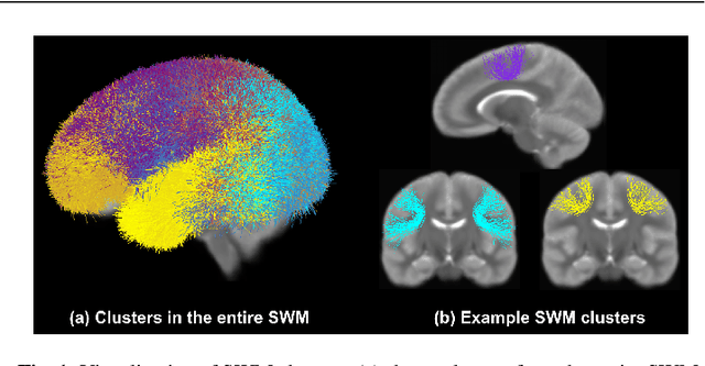 Figure 1 for Superficial White Matter Analysis: An Efficient Point-cloud-based Deep Learning Framework with Supervised Contrastive Learning for Consistent Tractography Parcellation across Populations and dMRI Acquisitions