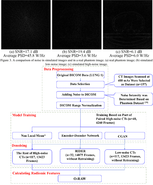 Figure 4 for Generative Models Improve Radiomics Reproducibility in Low Dose CTs: A Simulation Study