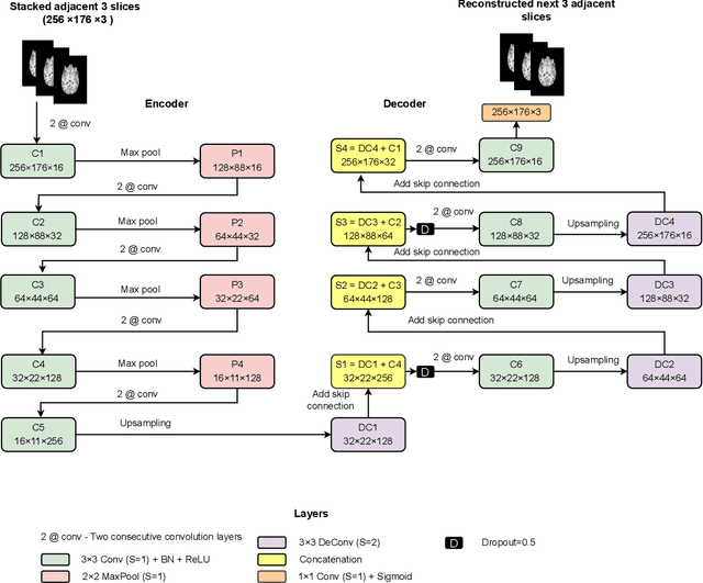 Figure 4 for Outlier-based Autism Detection using Longitudinal Structural MRI