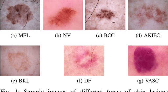 Figure 1 for TopoResNet: A hybrid deep learning architecture and its application to skin lesion classification