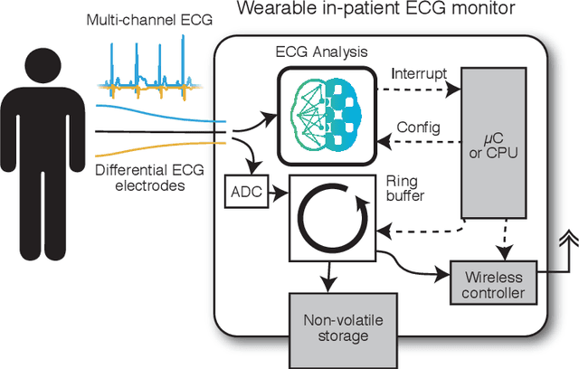 Figure 1 for Real-time ultra-low power ECG anomaly detection using an event-driven neuromorphic processor