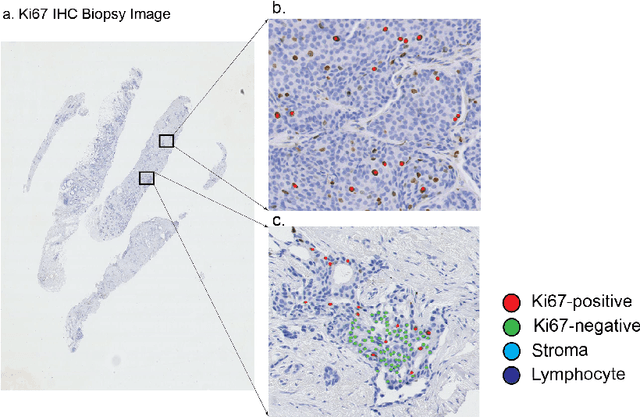 Figure 1 for DeepSDCS: Dissecting cancer proliferation heterogeneity in Ki67 digital whole slide images