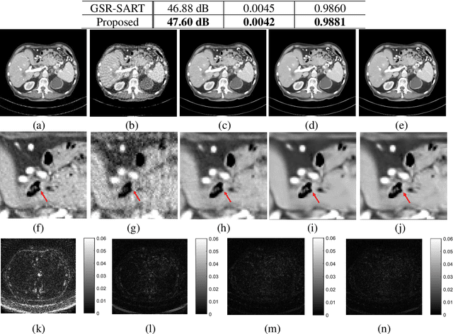 Figure 2 for Nonconvex ${L_ {1/2}} $-Regularized Nonlocal Self-similarity Denoiser for Compressive Sensing based CT Reconstruction