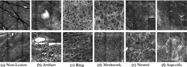 Figure 1 for Segmentation of Cellular Patterns in Confocal Images of Melanocytic Lesions in vivo via a Multiscale Encoder-Decoder Network (MED-Net)