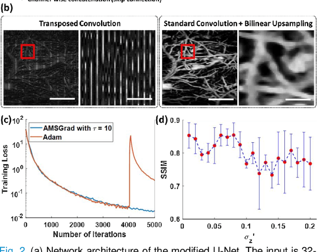 Figure 2 for Deep Image Prior for Sparse-sampling Photoacoustic Microscopy