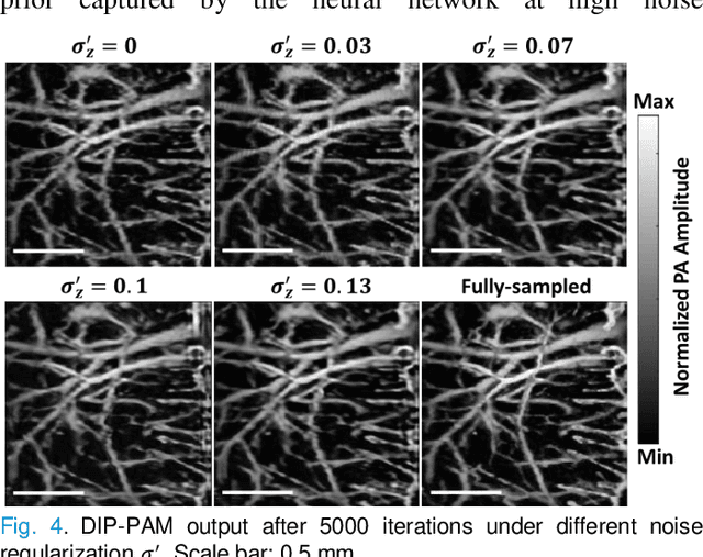 Figure 4 for Deep Image Prior for Sparse-sampling Photoacoustic Microscopy