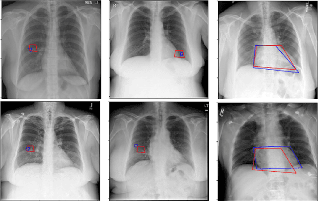 Figure 4 for Bimodal network architectures for automatic generation of image annotation from text