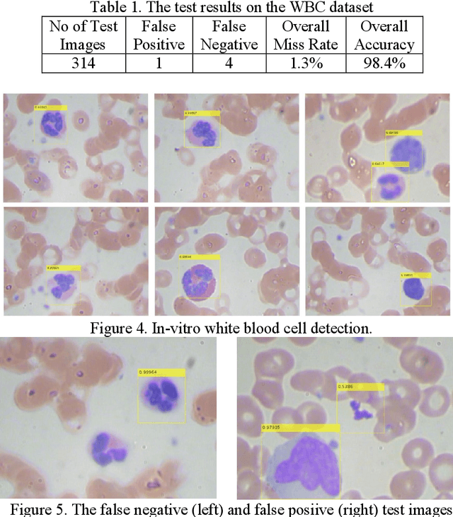 Figure 2 for Automated Blood Cell Detection and Counting via Deep Learning for Microfluidic Point-of-Care Medical Devices