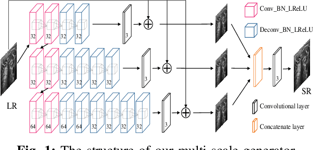 Figure 1 for Perception Consistency Ultrasound Image Super-resolution via Self-supervised CycleGAN