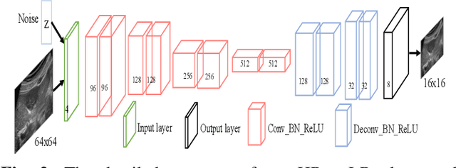 Figure 2 for Perception Consistency Ultrasound Image Super-resolution via Self-supervised CycleGAN