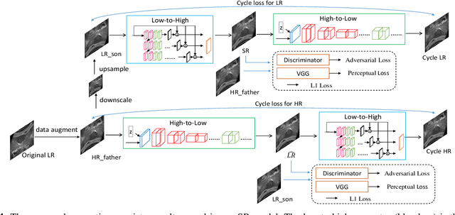 Figure 4 for Perception Consistency Ultrasound Image Super-resolution via Self-supervised CycleGAN