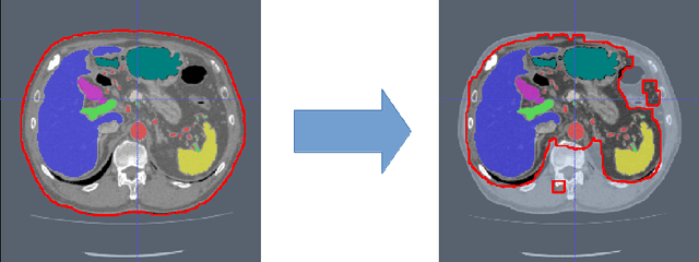Figure 1 for Hierarchical 3D fully convolutional networks for multi-organ segmentation