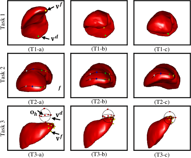 Figure 4 for Incorporating Prior Knowledge into Reinforcement Learning for Soft Tissue Manipulation with Autonomous Grasping Point Selection