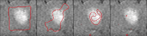 Figure 3 for The Stability of Convergence of Curve Evolutions in Vector Fields