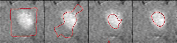 Figure 4 for The Stability of Convergence of Curve Evolutions in Vector Fields