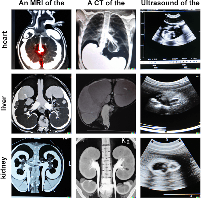 Figure 2 for What Does DALL-E 2 Know About Radiology?