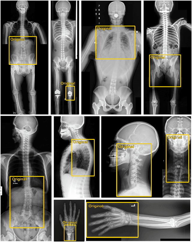 Figure 4 for What Does DALL-E 2 Know About Radiology?
