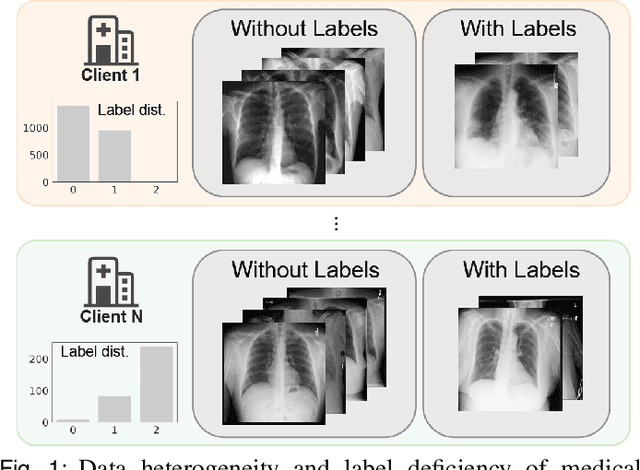 Figure 1 for Label-Efficient Self-Supervised Federated Learning for Tackling Data Heterogeneity in Medical Imaging