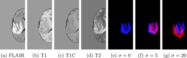 Figure 1 for Label noise in segmentation networks : mitigation must deal with bias