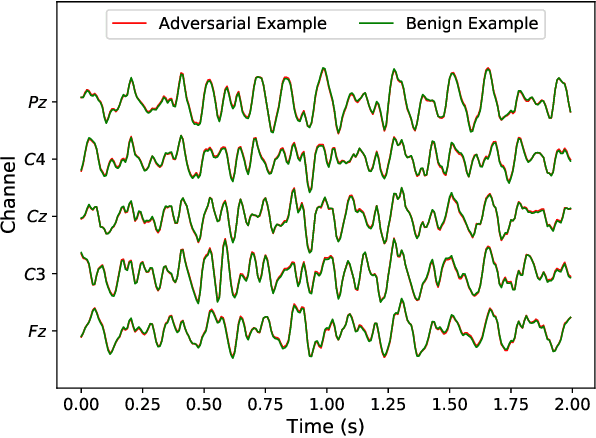 Figure 3 for Universal Adversarial Perturbations for CNN Classifiers in EEG-Based BCIs