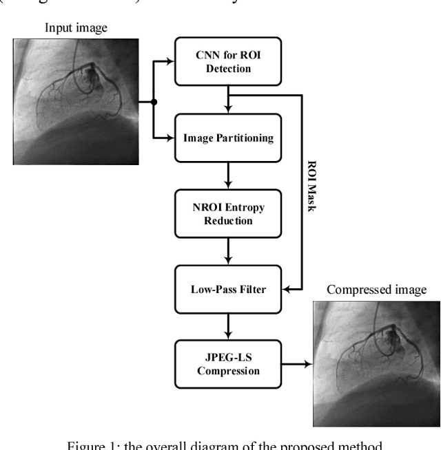 Figure 1 for Lossless Compression of Angiogram Foreground with Visual Quality Preservation of Background